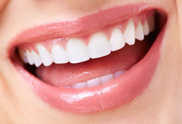 Porcelain Crown Dental
