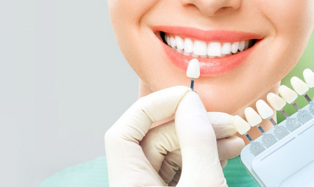 Porcelain Dental Crowns